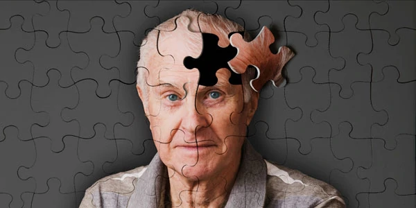 Alzheimer Hastalığı Hemşirelik Bakım Planı